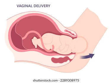 Epidural Vaginal Delivery - Specialist Gynaecology Treatment in Bangalore